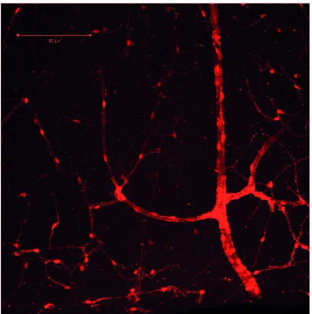red pericytes on blood vessels in the cerebral cortex of mouse