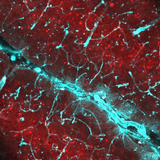 image of labelled astrocytes and blood vessels in a brain slice of mouse hippocampus